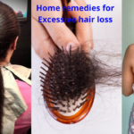Home Remedies For Excessive Hair Fall | Excessive Hair Loss