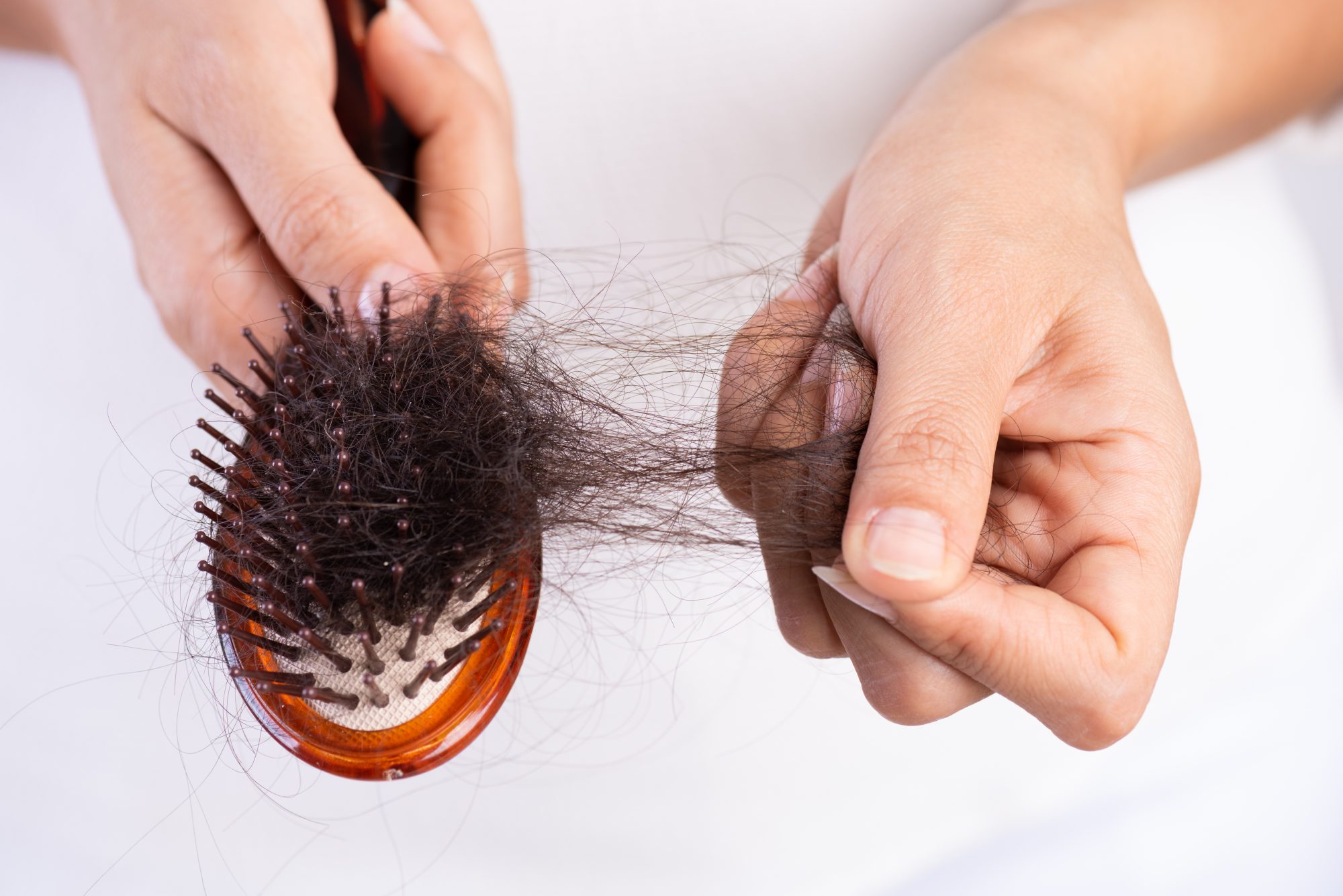 hairloss preventions
