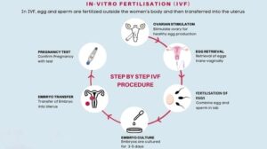 Test Tube Baby Or IVF Procedure | IVF- How It Works