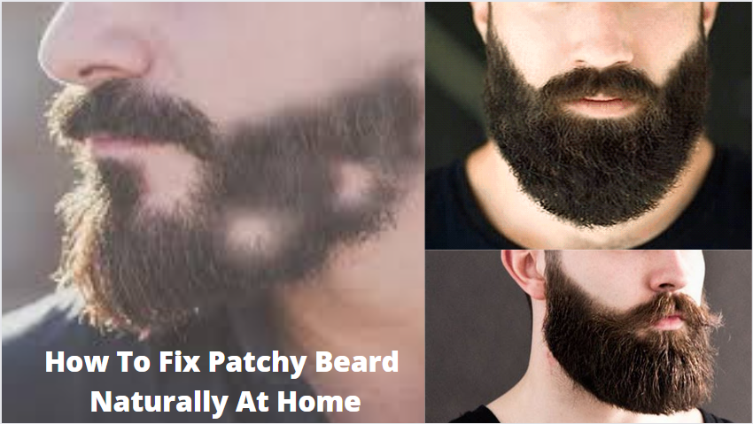 How To Fix Patchy Beard Naturally At Home