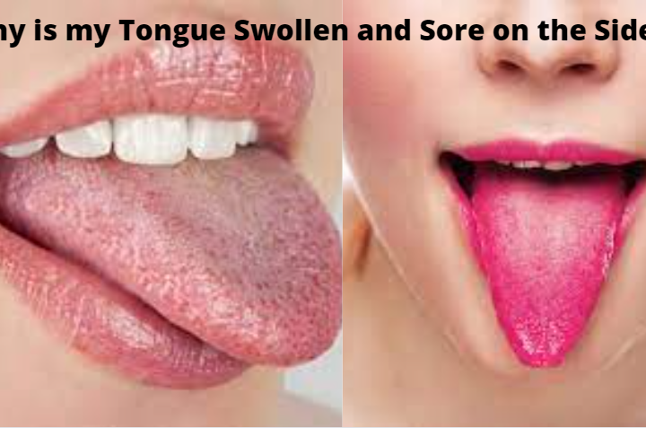 Why Is My Tongue Swollen And Sore On The Sides