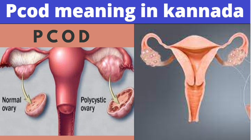 PCOD Meaning In Kannada