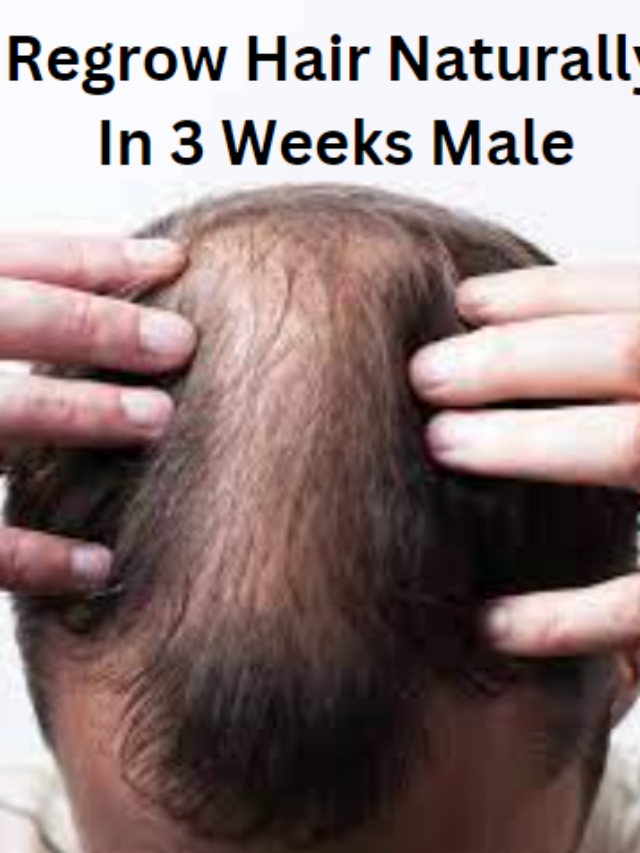 Regrow Hair Naturally In 3 Weeks Male