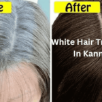White Hair Treatment In Kannada | ಬಿಳಿ ಕೂದಲಿಗೆ ಪರಿಹಾರ