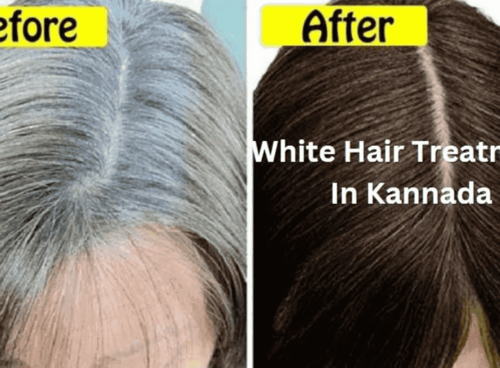 White Hair Treatment In Kannada | ಬಿಳಿ ಕೂದಲಿಗೆ ಪರಿಹಾರ