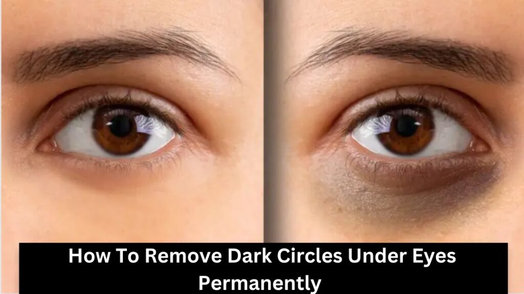 How To Remove Dark Circles Under Eyes Permanently At Home