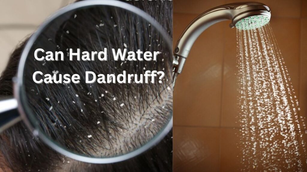 Can Hard Water Cause Dandruff Bright Cures