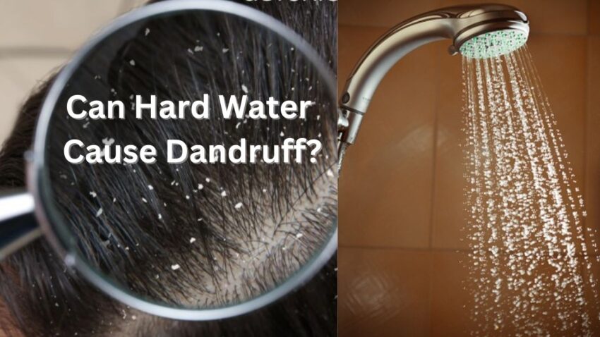 Can Hard Water Cause Dandruff