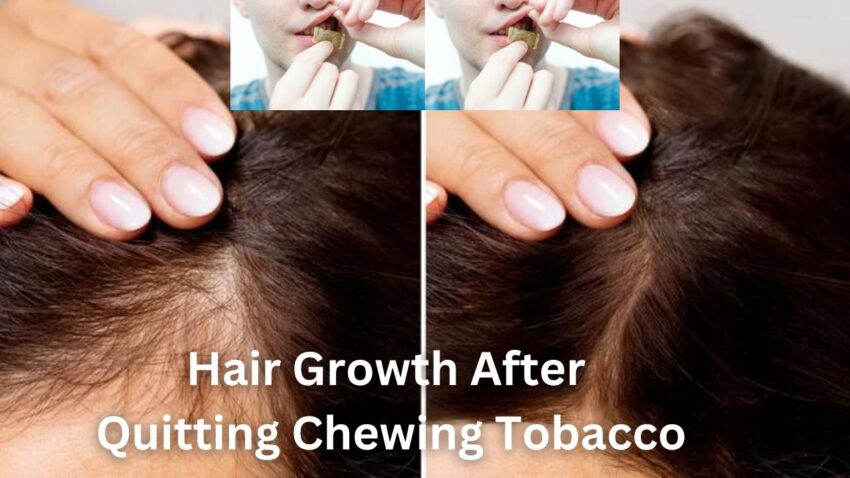 Know About Hair Growth After Quitting Chewing Tobacco