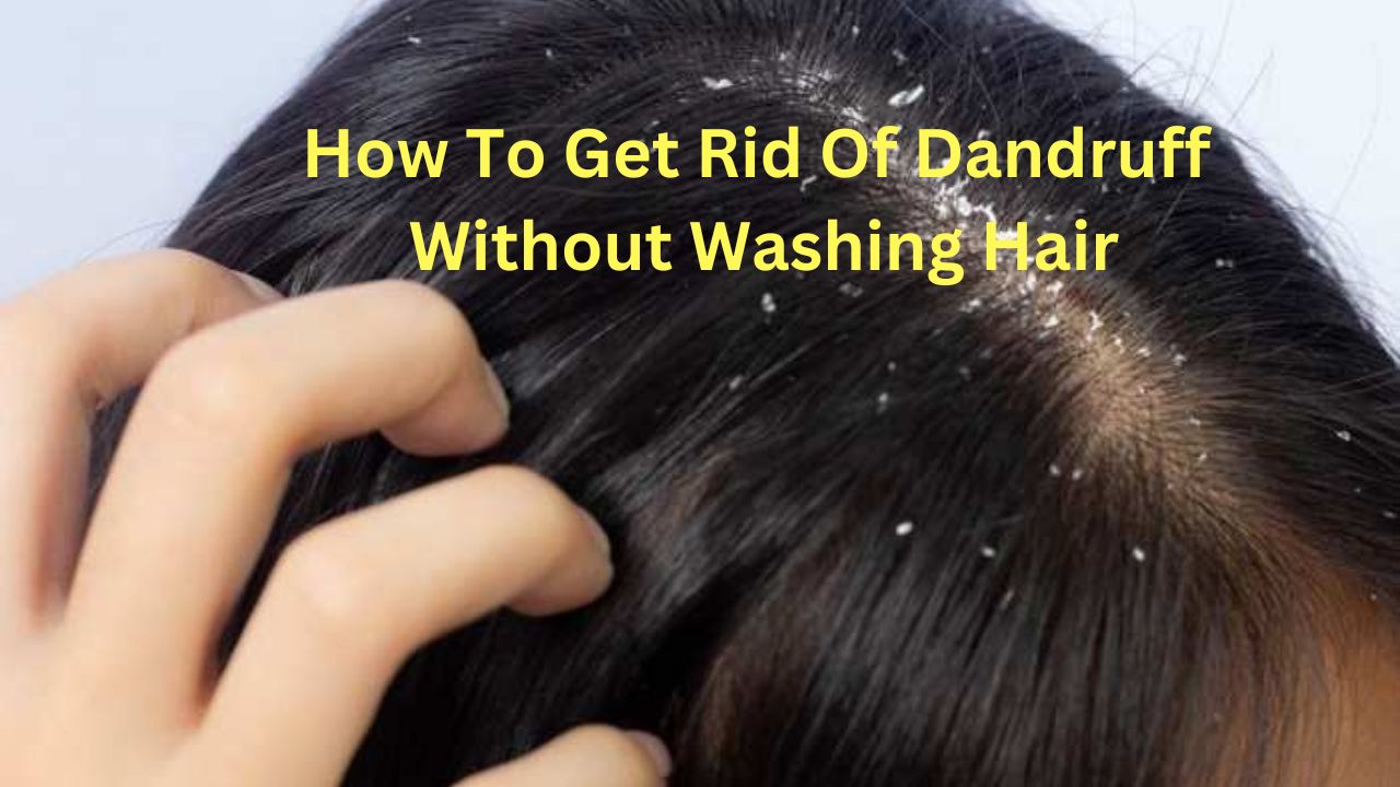 how to get rid of dandruff without washing it